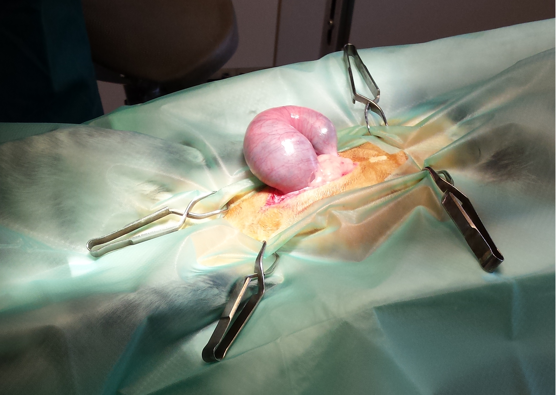 Baarmoeder ontsteking Bubbels tijdens operatie